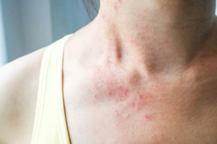 Rashes common rash skin infographic nursing types health nurse medical school body chart dermatology conditions itch tips wound guide disease Rashes common rash skin infographic nursing types health nurse medical school body chart dermatology conditions itch tips wound guide disease