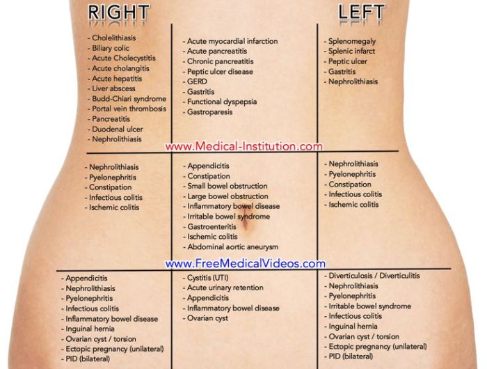 How to Diagnose 10 Types of Abdominal Pain