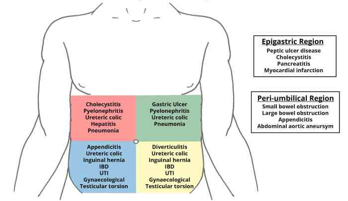 How to Diagnose 10 Types of Abdominal Pain