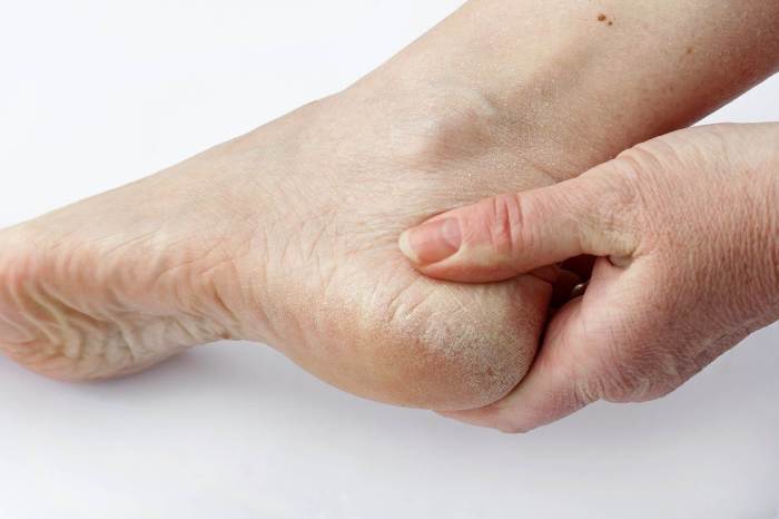 Diagnosing 3 Types of Foot Problems