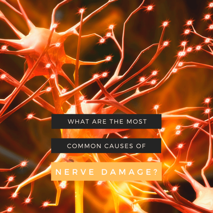 8 Common Causes of Nerve Pain and How to Diagnose Them
