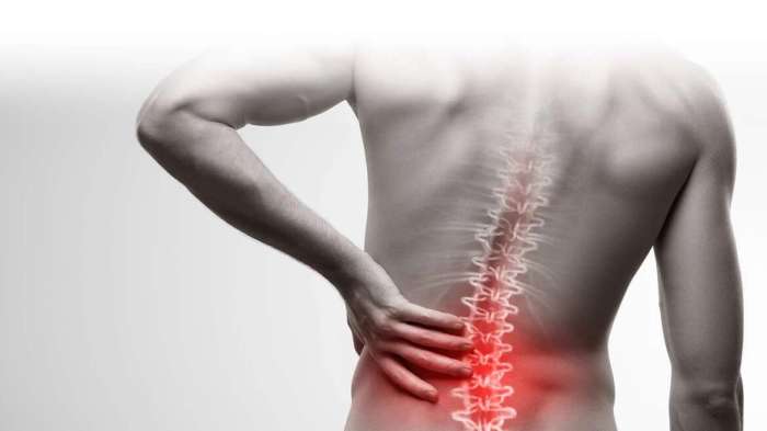 Diagnosing 3 Types of Back Pain